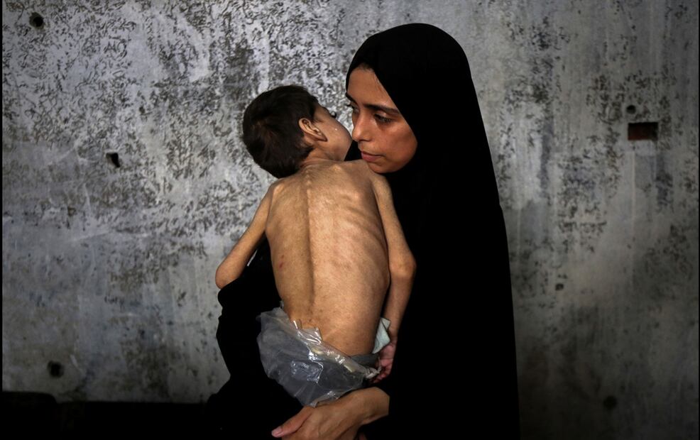 Una mujer carga a un niño palestino que sufre desnutrición y parálisis cerebral en una escuela convertida en refugio, en el noroeste de la Ciudad de Gaza, el 25 de julio de 2025. Foto: Xinhua