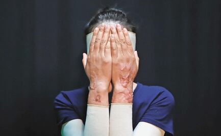 Cae "El Charrez", supuesto primer autor intelectual del ataque con ácido a saxofonista