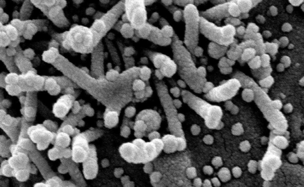 N501Y: Lo que sabemos de la variante del Covid-19 hallada en Sudáfrica