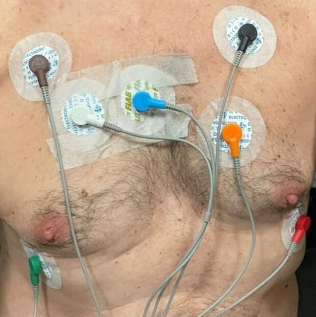 Juan José Origel está hospitalizado y podría necesitar marcapasos