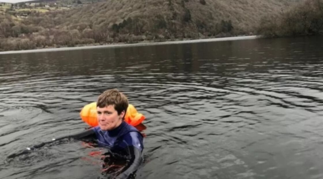 Covid prolongado: paciente relata los efectos de la "niebla mental" que padece desde hace 18 meses