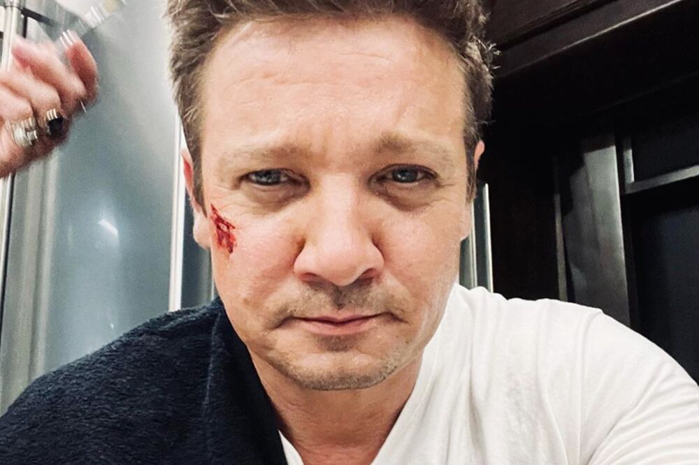 Jeremy Renner cumplió 52 años mientras seguía hospitalizado por el accidente que sufrió, cuando un quitanieves lo aplastó, dejándole 30 fracturas. 
Foto: Instagram