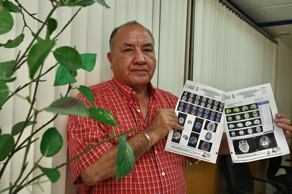 El médico José Maximiliano Rodríguez presenta baja oxigenación hacia el cerebro cinco años después de contagiarse de Covid-19. Foto: Berenice Fregoso