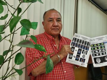 Covid persistente: la batalla de quienes siguen enfermos cinco años después
