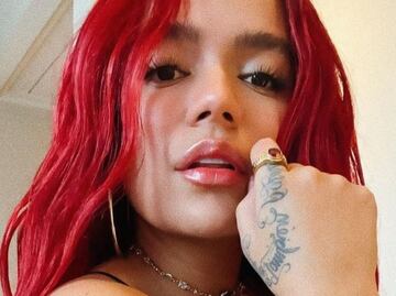 Karol G: la mala experiencia que pasó la Bichota en el quirófano