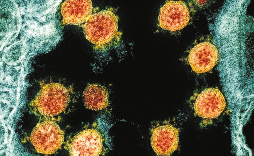 Foto: NIAID/National Institutes of Health via AP, archivo