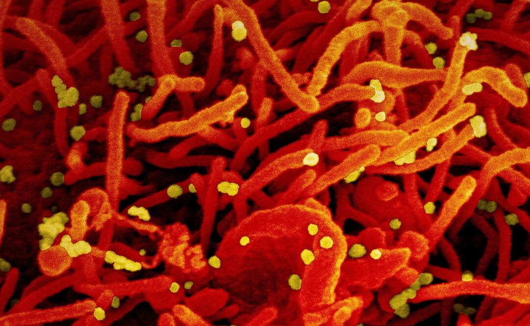 Foto: EFE/EPA/NIAID/NATIONAL INSTITUTES OF HEALTH 