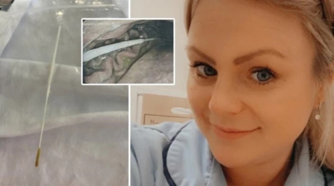 Mujer se hace prueba casera de Covid-19 y termina en el hospital por tragarse el hisopo