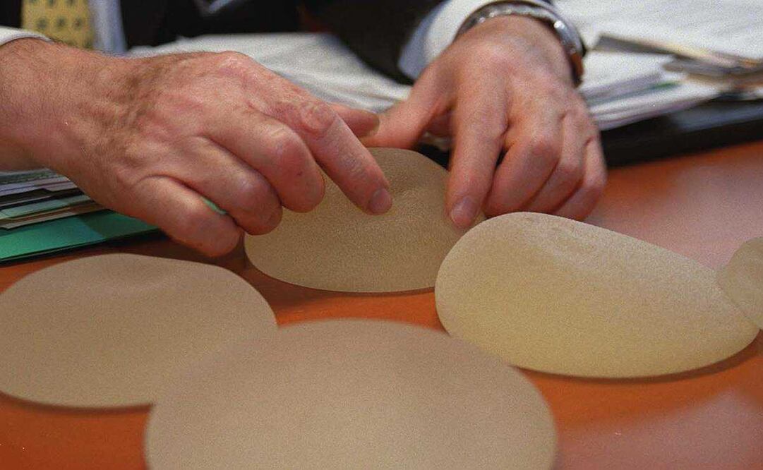 Denuncian exceso de cirugías en jovencitas de Sinaloa