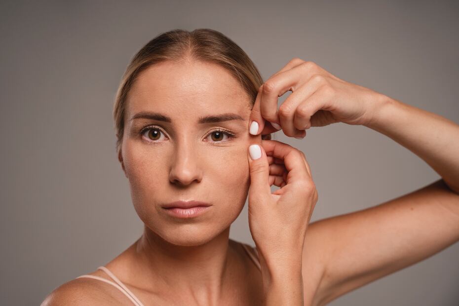 La ptosis palpebral puede ser congénita o adquirida. Foto: Freepik