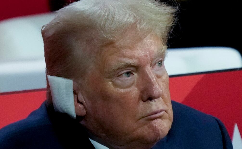 Trump quedó con una herida en la oreja luego de sufrir un intento de asesinato. Foto: AP