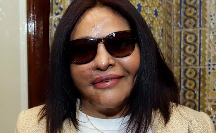 Lo que sabemos del caso Carmen Sánchez, víctima que logró sentencia histórica contra ataque con ácido