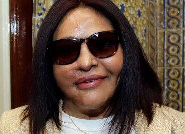 Carmen Sánchez, víctima de ataque con ácido, denuncia amenazas y acoso