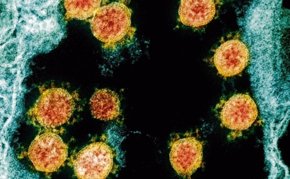 Descubren que proteína del coronavirus presenta 13 mutaciones a la vez en Tanzania