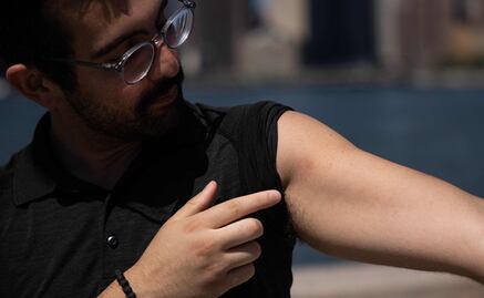 "Los peores dolores de mi vida": neoyorquino cuenta cómo fue tener viruela del mono