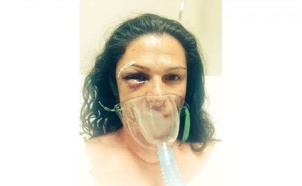 Golpean a Ana Gabriela Guevara 