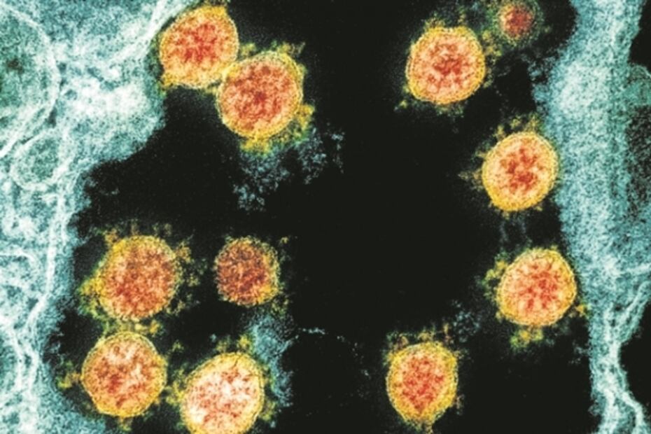 Bloquear al coronavirus: las investigaciones que buscan inhibir al SARS-CoV-2