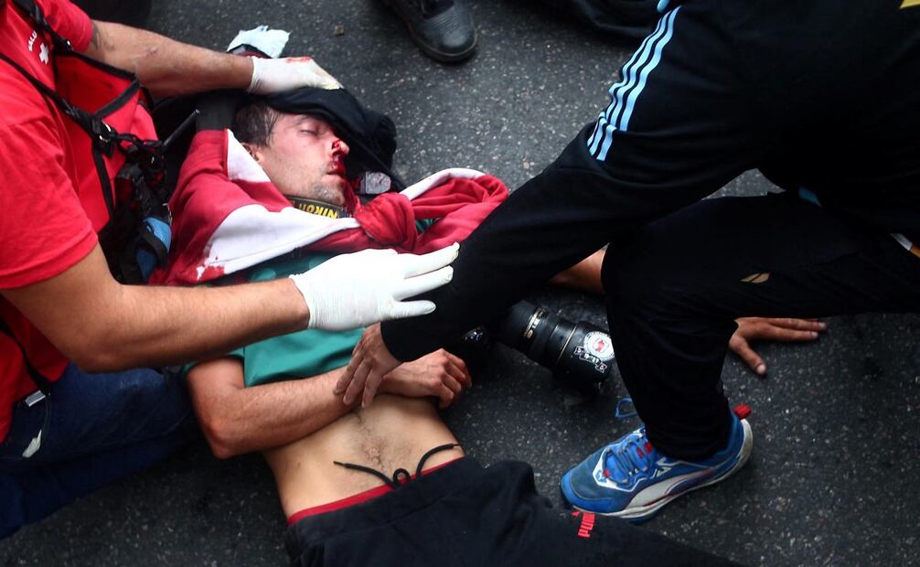 El fotoperiodista argentino Pablo Grillo recibe atención médica por parte de paramédicos tras resultar herido durante una protesta de jubilados, apoyada por aficionados al fútbol, ​​contra el gobierno del presidente Javier Milei en Buenos Aires el 12 de marzo de 2025. Foto: AFP