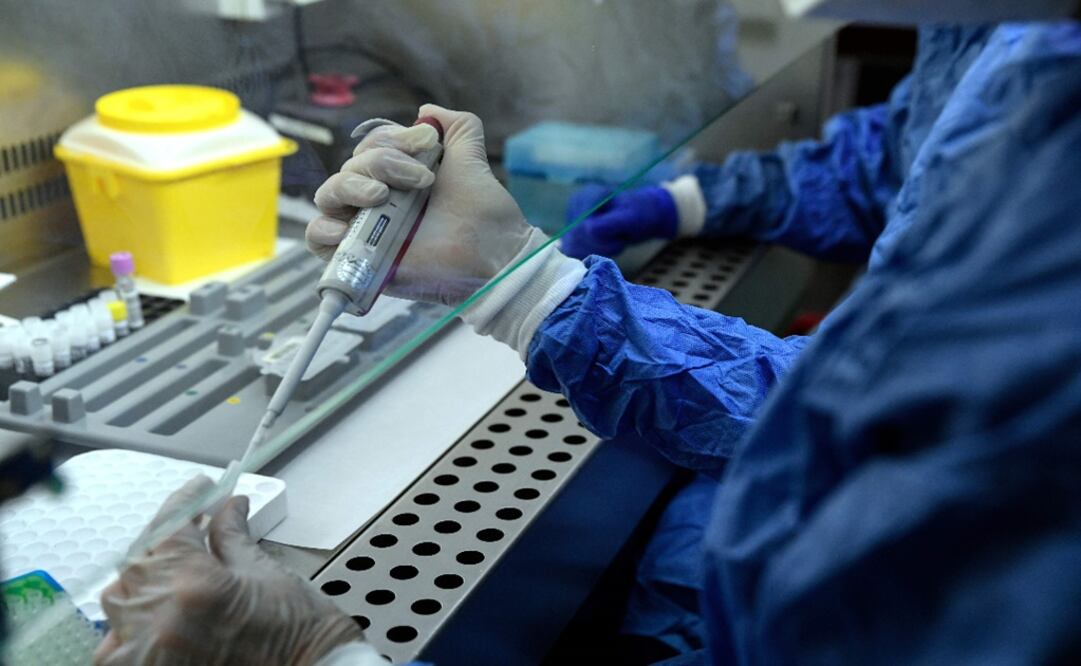 A healthcare worker conducts Polymerase Chain Reaction (PCR) tests at the microbiology lab - Photo: Oscar del Pozo/AFP