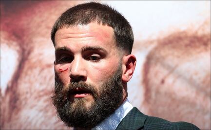 Así quedó el rostro de Caleb Plant tras la bronca con el 'Canelo' Álvarez