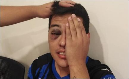 Aficionado de Gallos Blancos casi pierde un ojo por ganar playera de Sanvezzo