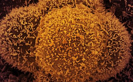 Covid-19: "Anticuerpos deshonestos", cuando nuestro propio cuerpo juega sucio