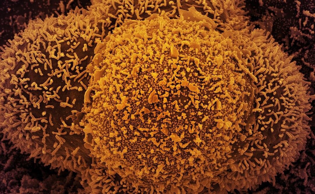 Foto: EFE/EPA/NIAID/NATIONAL INSTITUTES OF HEALTH