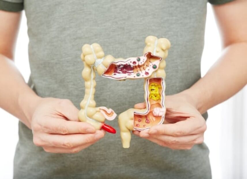 Tomar una infusión de cuachalalate y chupandilla podría aliviar tu colitis, asegura estudio del IPN y la UNAM  