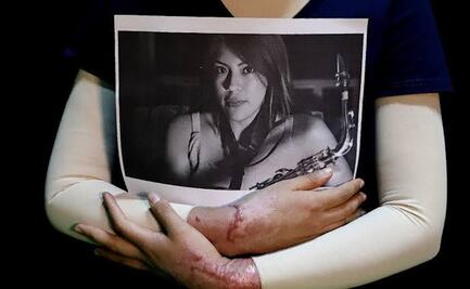 CDMX publica "Ley Malena"; ataques con ácido u otros químicos serán considerados tentativa de feminicidio