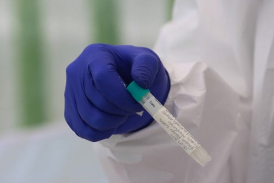 Londres crea una prueba de Covid-19 con resultados en 90 minutos