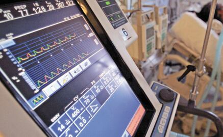 The Public Administration Ministry is investigating the purchase of ventilators from Cyber Robotics Solutions