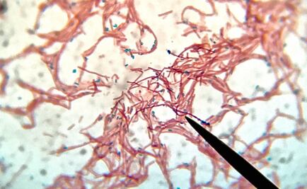 Aislan a una bacteria capaz de sobrevivir en el espacio