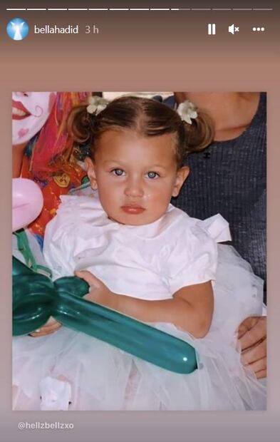 La cirugía plástica que sí se hizo Bella Hadid