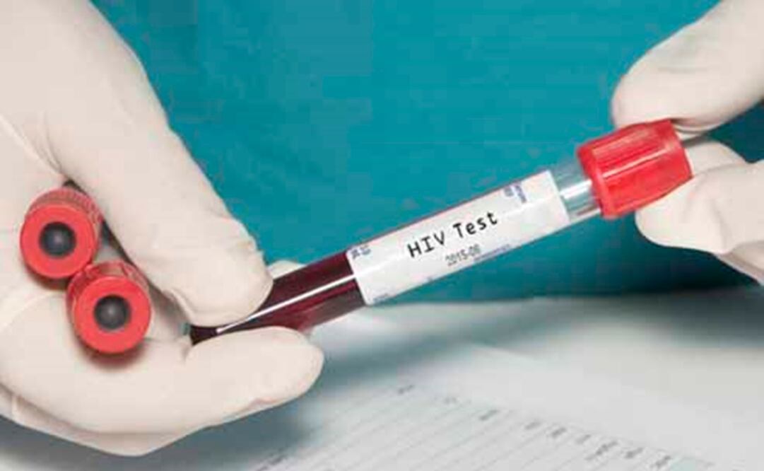 OMS preaprueba dos test para detectar VIH en bebés