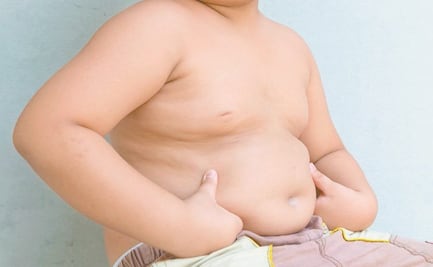 Impulsa PVEM reforma para frenar obesidad y desnutrición infantil 