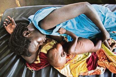 Decretan en Sudán del Sur emergencia por hambruna