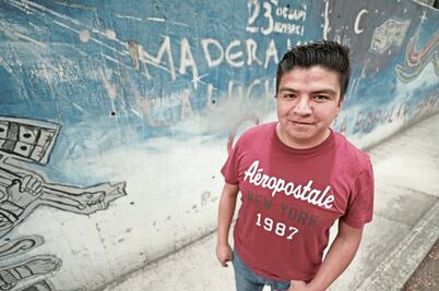 Lupus da más a mujeres que a hombres; 1% de población padece esta enfermedad