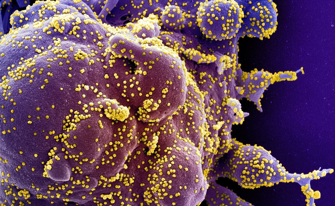 Foto: EFE/EPA/NIAID/NATIONAL INSTITUTES OF HEALTH HANDOUT