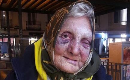 Jóvenes golpean a anciana indigente en Madrid 