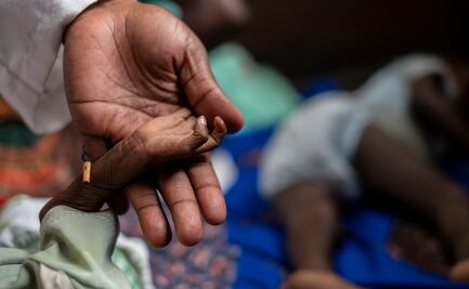 Casos de malaria pueden aumentar debido al cambio climático en África