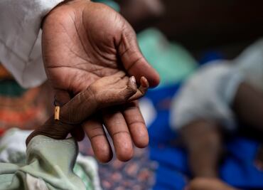 Casos de malaria pueden aumentar debido al cambio climático en África