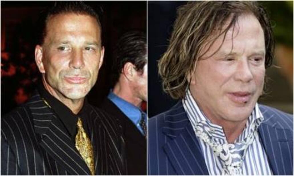 Fher de Maná y otros famosos que han sorprendido por su rostro