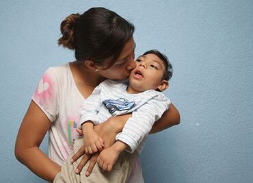 Microcefalia por zika en México