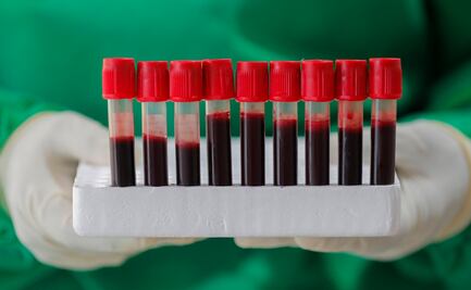 Análisis de sangre preliminar detecta tumores cuatro años antes