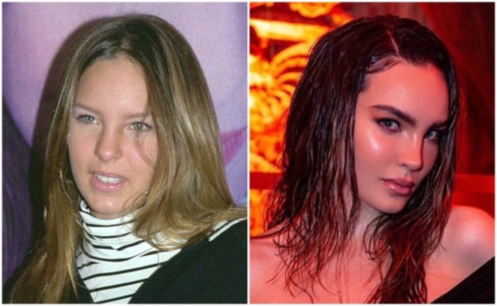 Así ha cambiado el rostro de estas famosas después de las cirugías y el bótox 