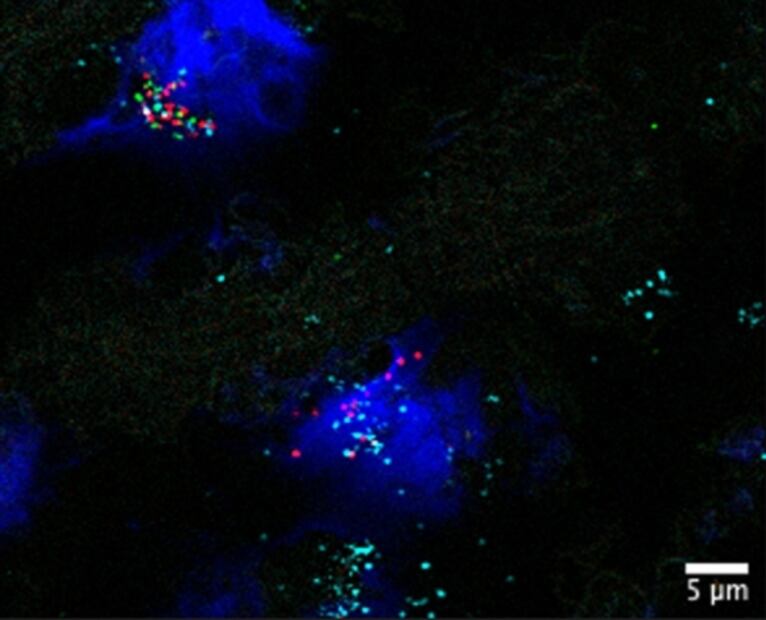 Crean el mapa celular más detallado del corazón contra enfermedades cardíacas