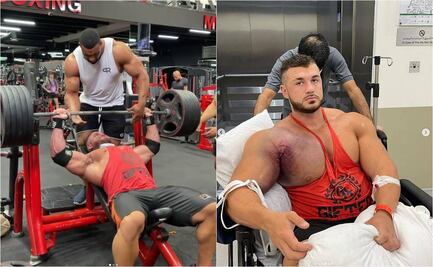 Fisicoculturista de EU se rompe un tendón pectoral por intentar cargar 220 kilos
