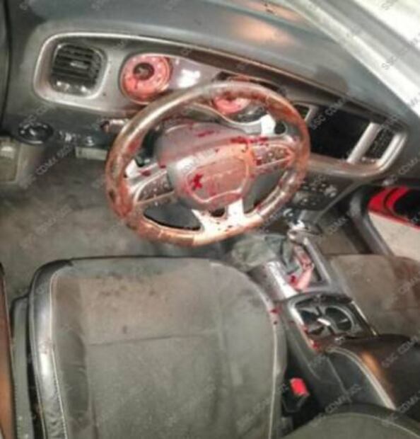 Balean a niña de 9 años y a su padre mientras viajaban en auto en la alcaldía Miguel Hidalgo