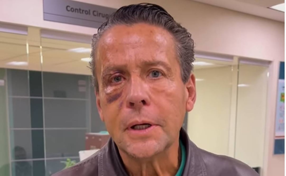 Alfredo Adame fue golpeado hace unos días en la calle de la CDMX. Foto: Captura.