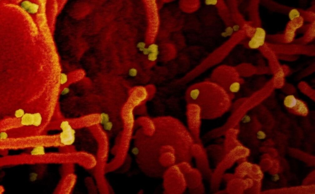 Científicos mexicanos descubren células agravantes de la covid-19